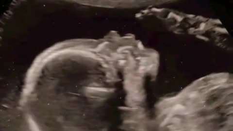 Amazing and mind blowing viral video 2023