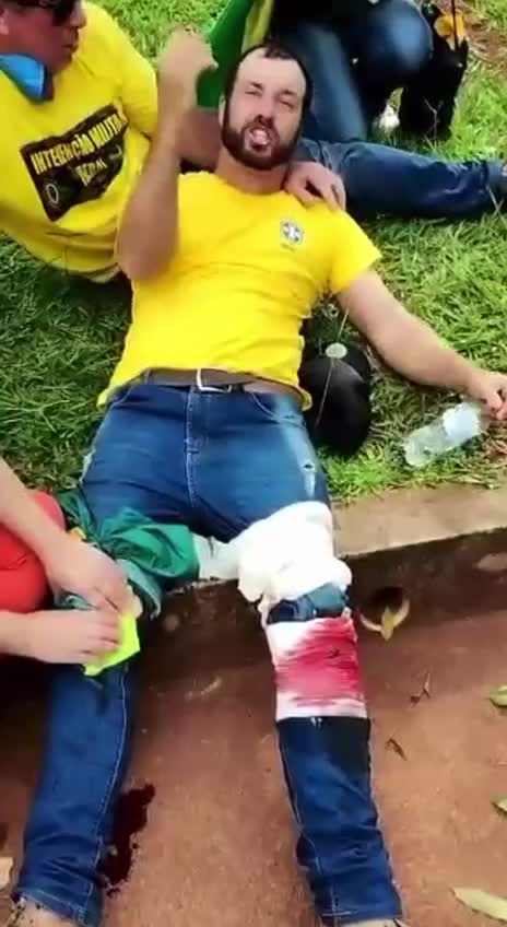 Protester may have been hit by live ammunition. They are shooting people with real bullets