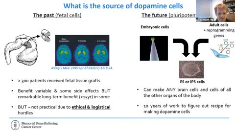 Cell Based Approaches to Treating Parkinson's Disease