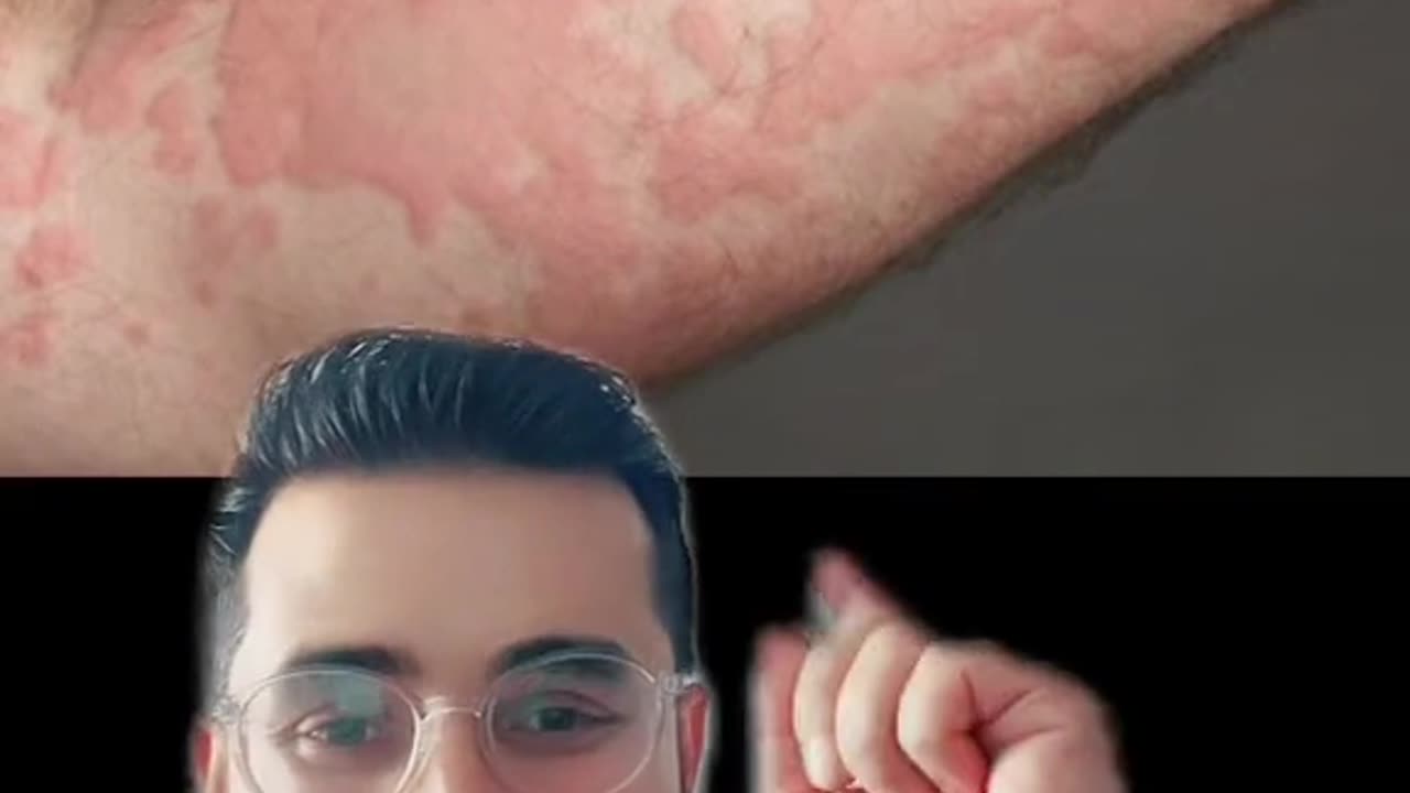 Acne Dermatologist Problems and Solutions