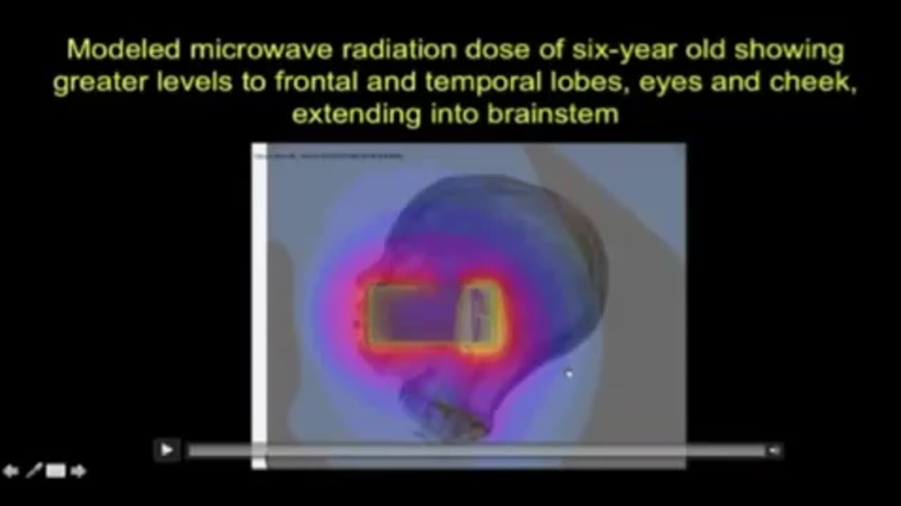 Radiation we expose to ourselves and children