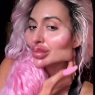 Plastic Surgery Screwup