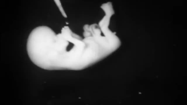 It's Clearly a Baby