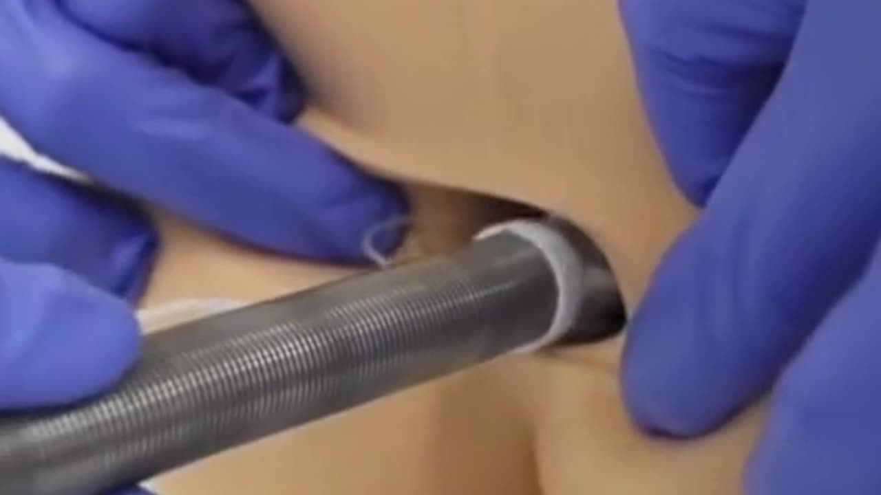 This new medical tool is gonna change the industry
