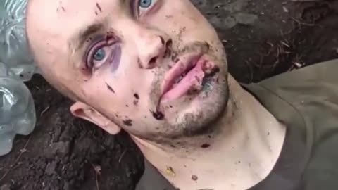 Abandoned Ukrainian soldier found by Russian forces tells his story.