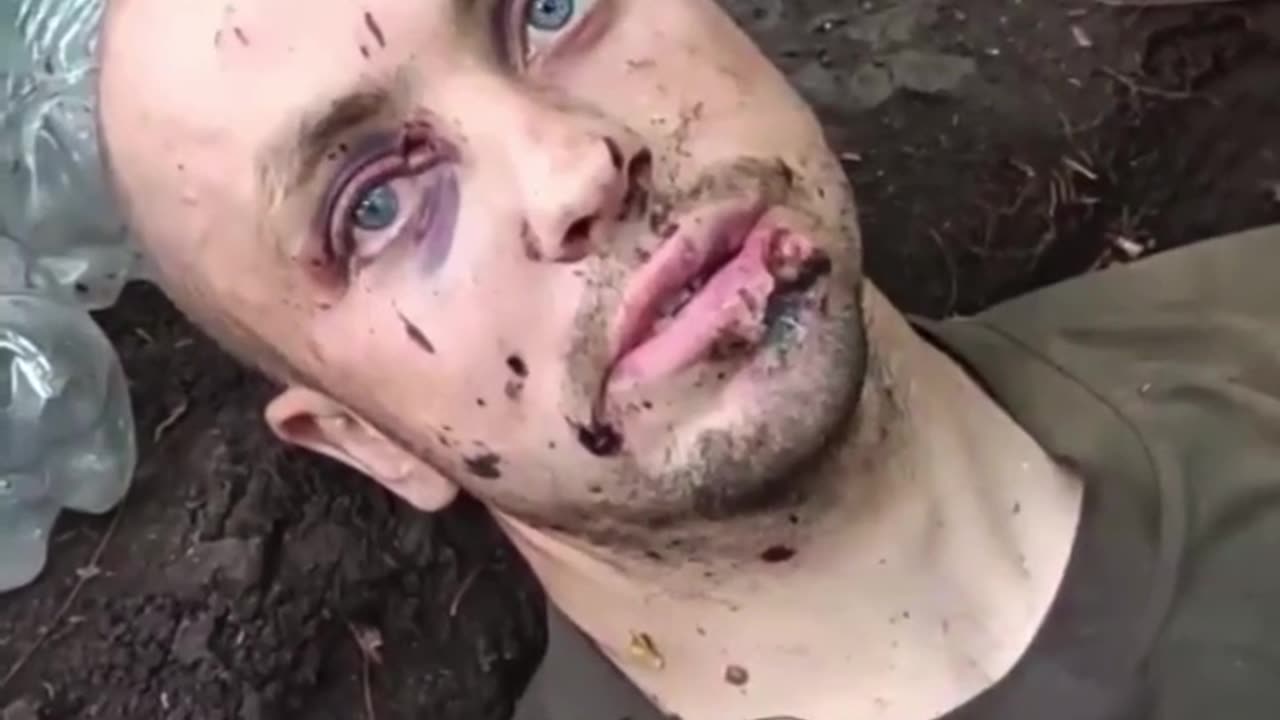Abandoned Ukrainian soldier found by Russian forces tells his story.