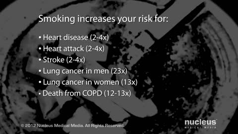 How Smoking Kills