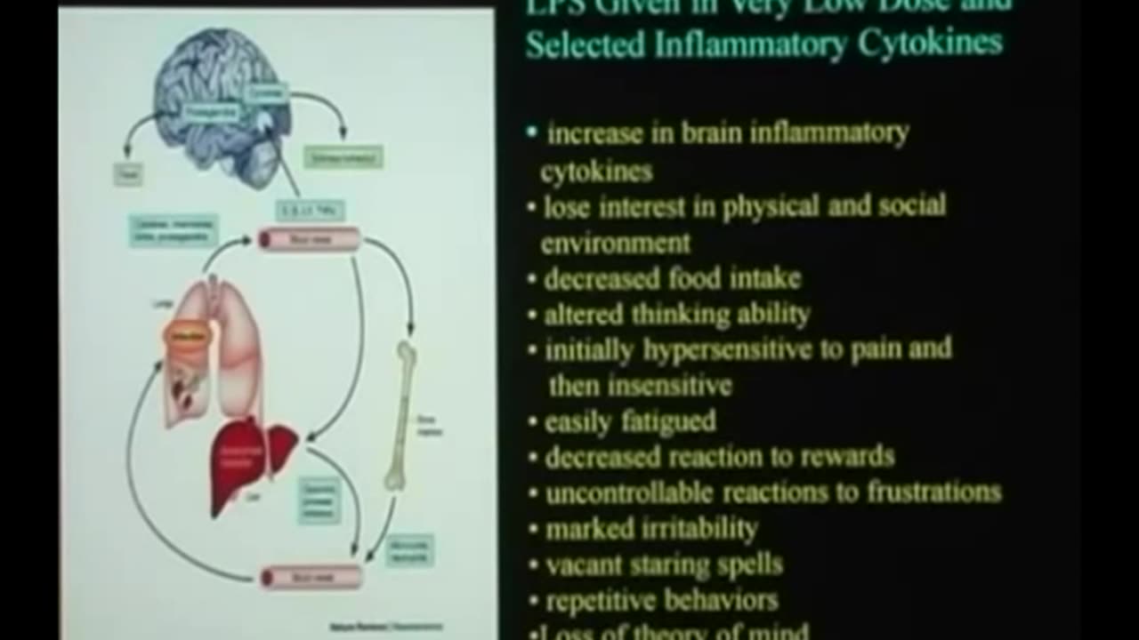 Vaccines And Brain Development - Dr Russell Blaylock, MD (2008)