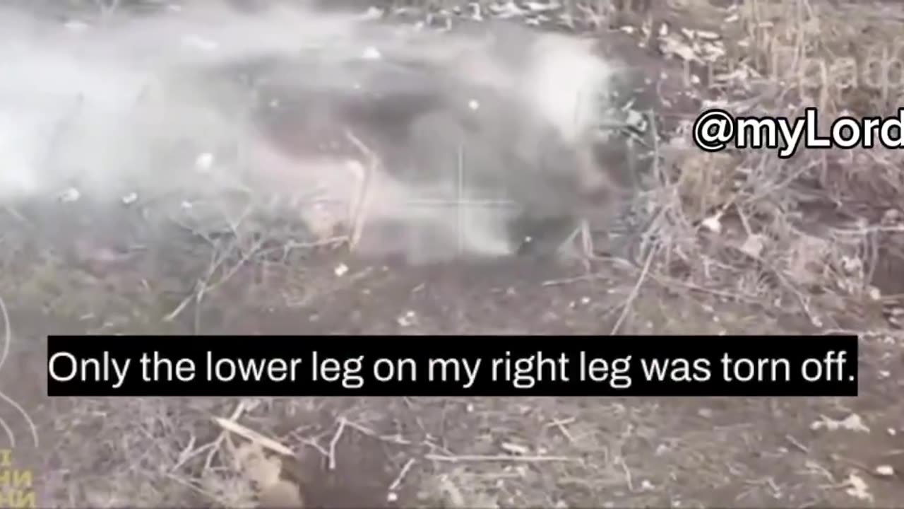 Every soldier wishes to lose his leg below the knee to go home”— Ukrainian morale