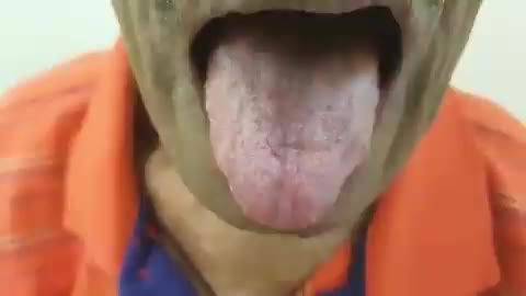 tongue fasciculation