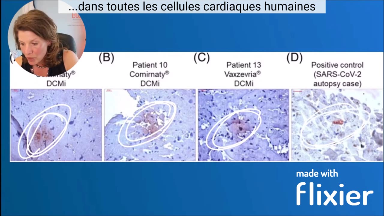 Injections covid : «Je suis désolée! Honte à moi.» - Dr. Annette Bosworth