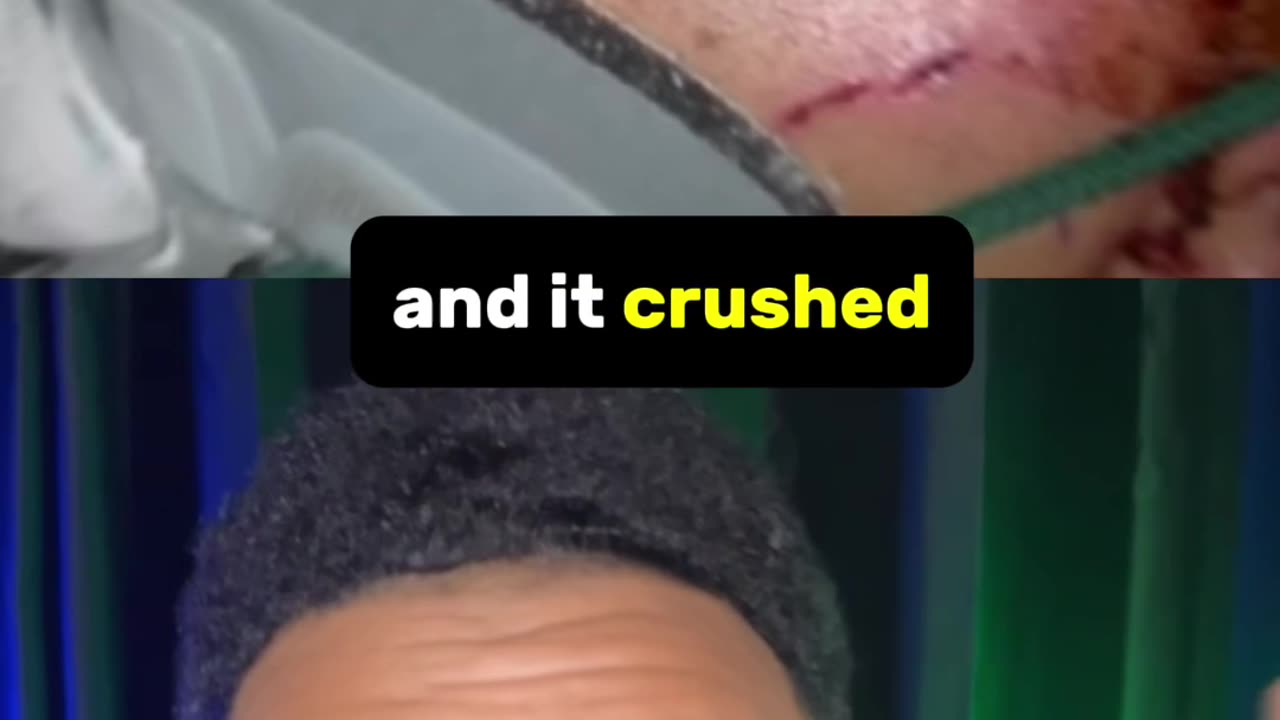 10k lb stone CRUSHES MAN MIRACLE 😱