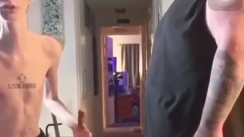 Slap Contest Gone Wrong