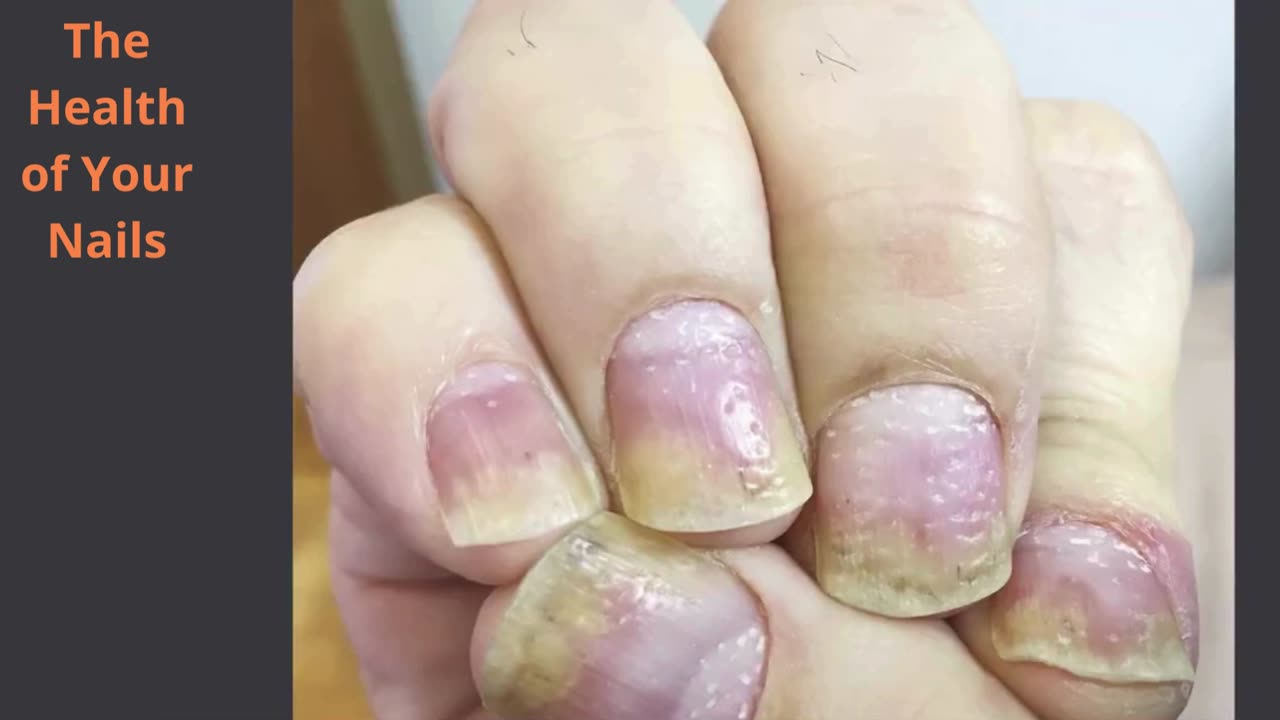 The Health of Your Nails and Skin