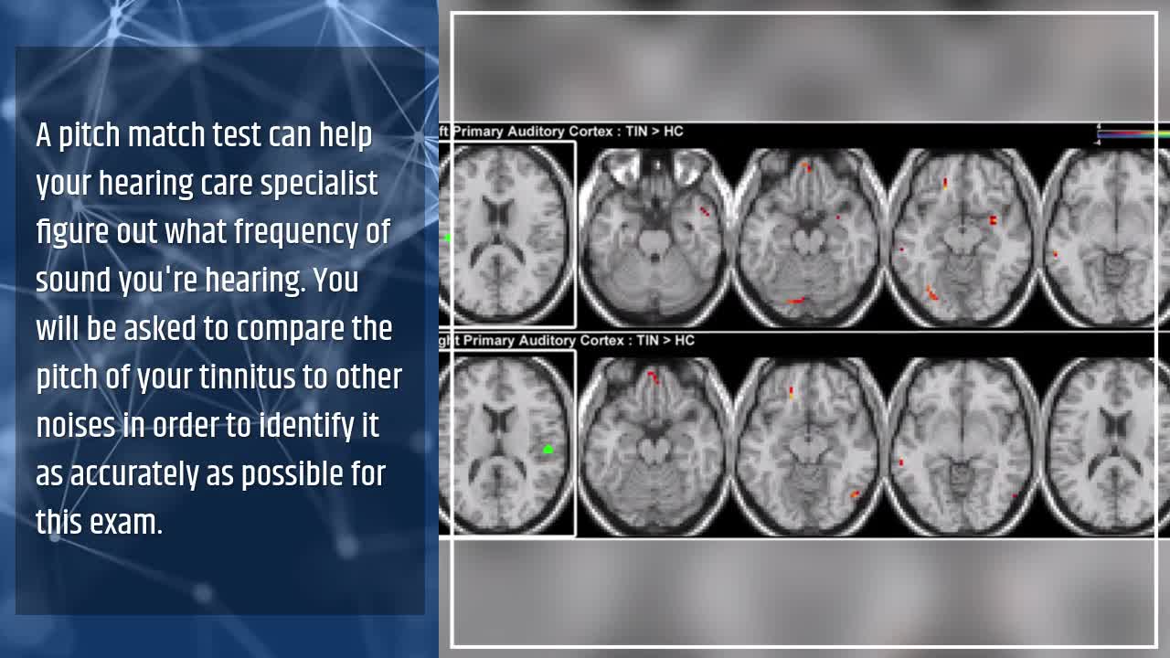 Treatment and Diagnosis of Tinnitus