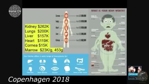 MAX IGAN- Human harvesting is BIG$$$ BUSINESS!!