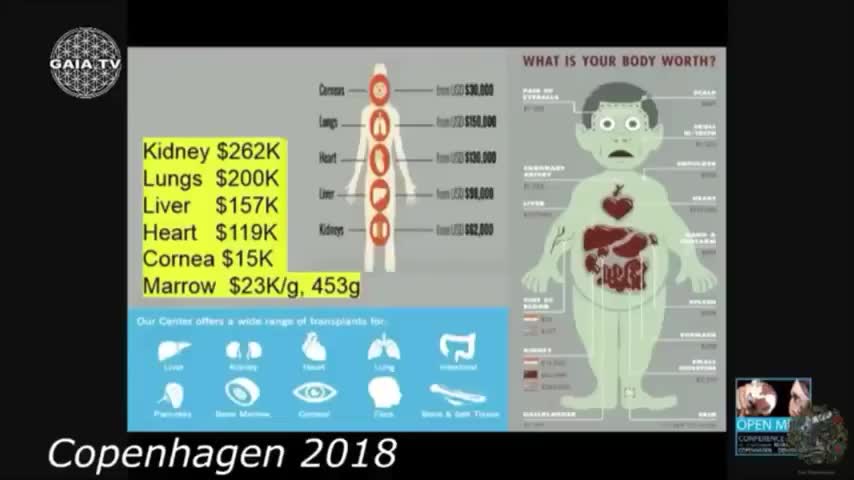 MAX IGAN- Human harvesting is BIG$$$ BUSINESS!!