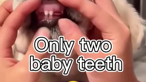 two teeths in baby mouth