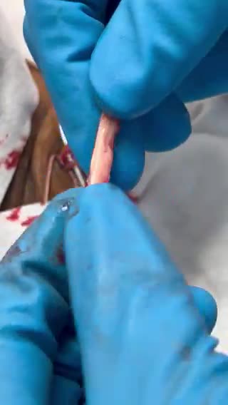 A Clot from the CLOTSHOT