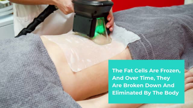 Cryolipolysis
