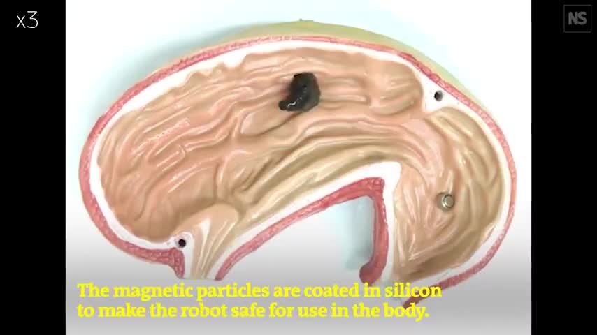 Magnetic miniature soft-bodied robots allow non-invasive access to restricted spaces