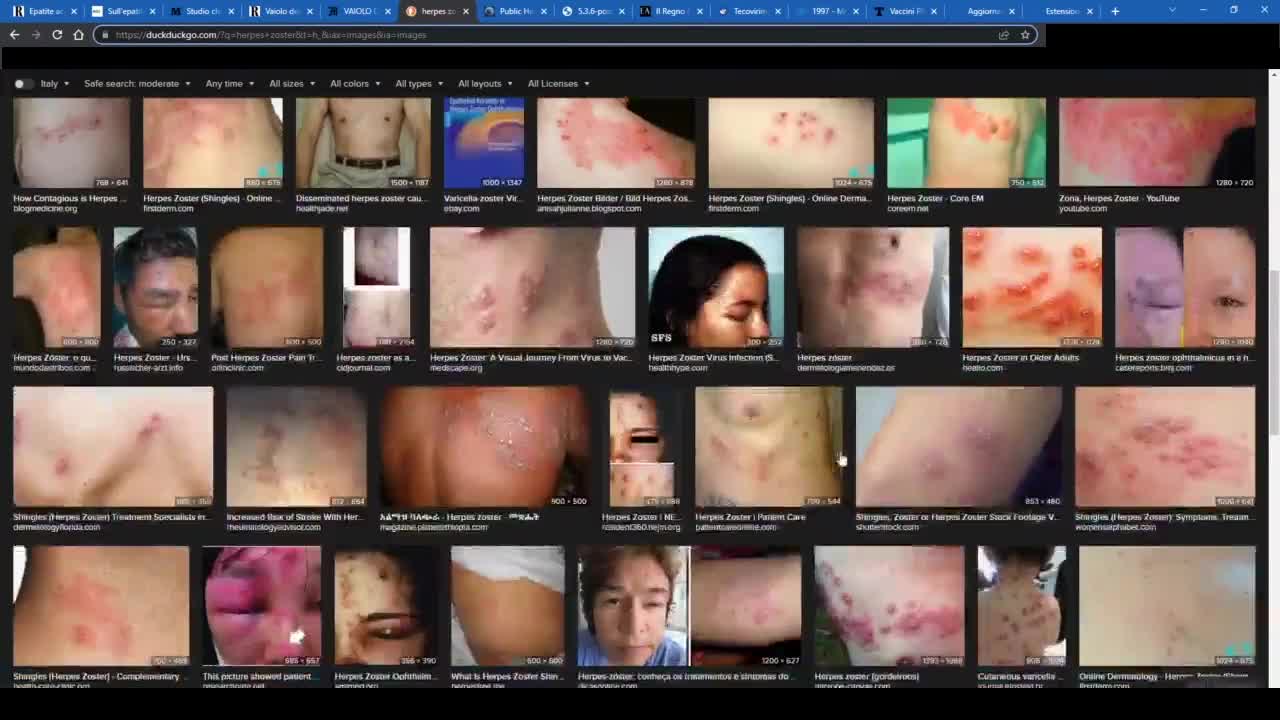 Quarta dose? ... riproponiamo a BOMBA la nostra video inchiesta FAKE MEDIAPOX:E