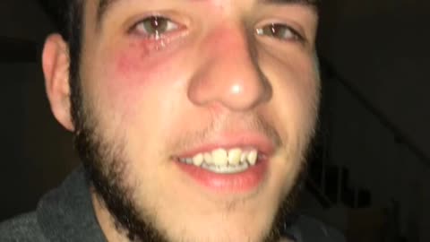 Two people flip girl hits man