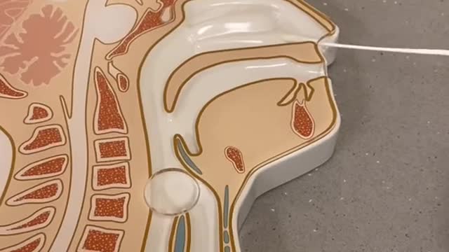 What a nasopharyngeal test is actually like
