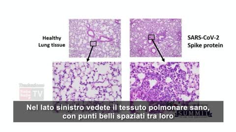 Vaccini e Proteina Spike Dott. Ryan N.Cole [SUB ITA]