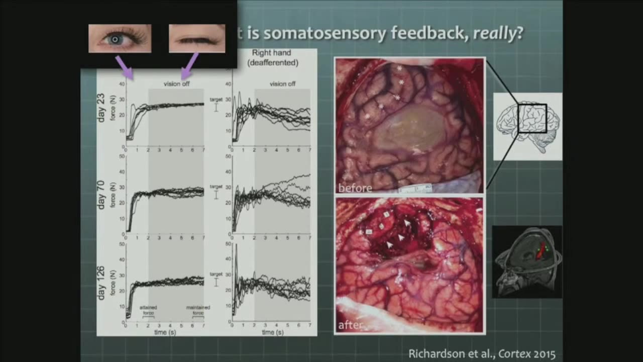 Brain Computer Interfaces Meet Body Area Network (Timothy Lucas, MD, PhD)