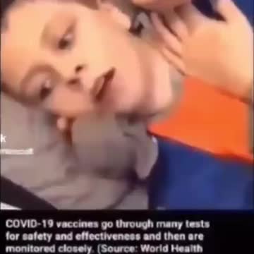 Poor baby having adverse effects for the DEATH VAX...PARENTS WAKE UP
