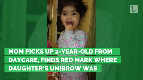 Mom Picks Up 2-Year-Old from Daycare, Finds Red Mark Where Daughter’s Unibrow Was