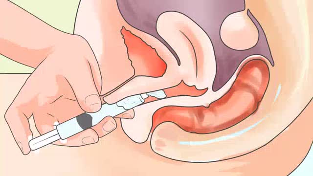 Vaginal Discharge Colours | Is My Discharge Normal:Thrush, Bacterial Vaginosis, STI, Yeast Infection