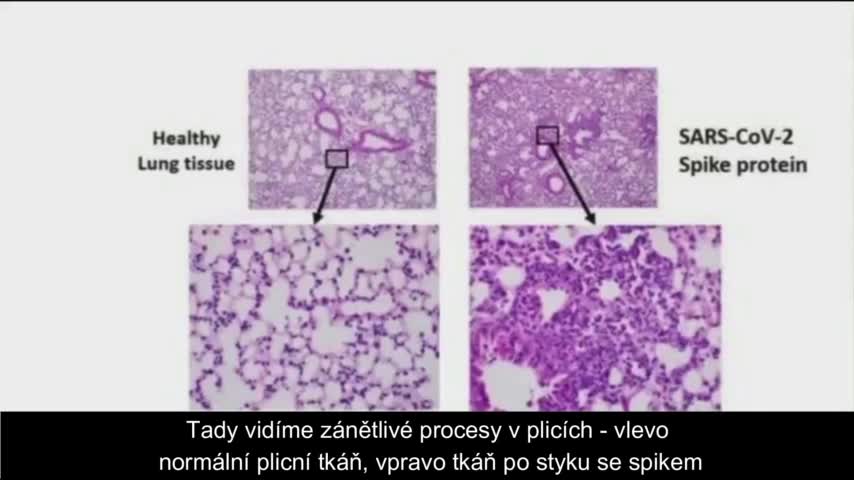 Dr. Cole spike protein poškozuje tkáně