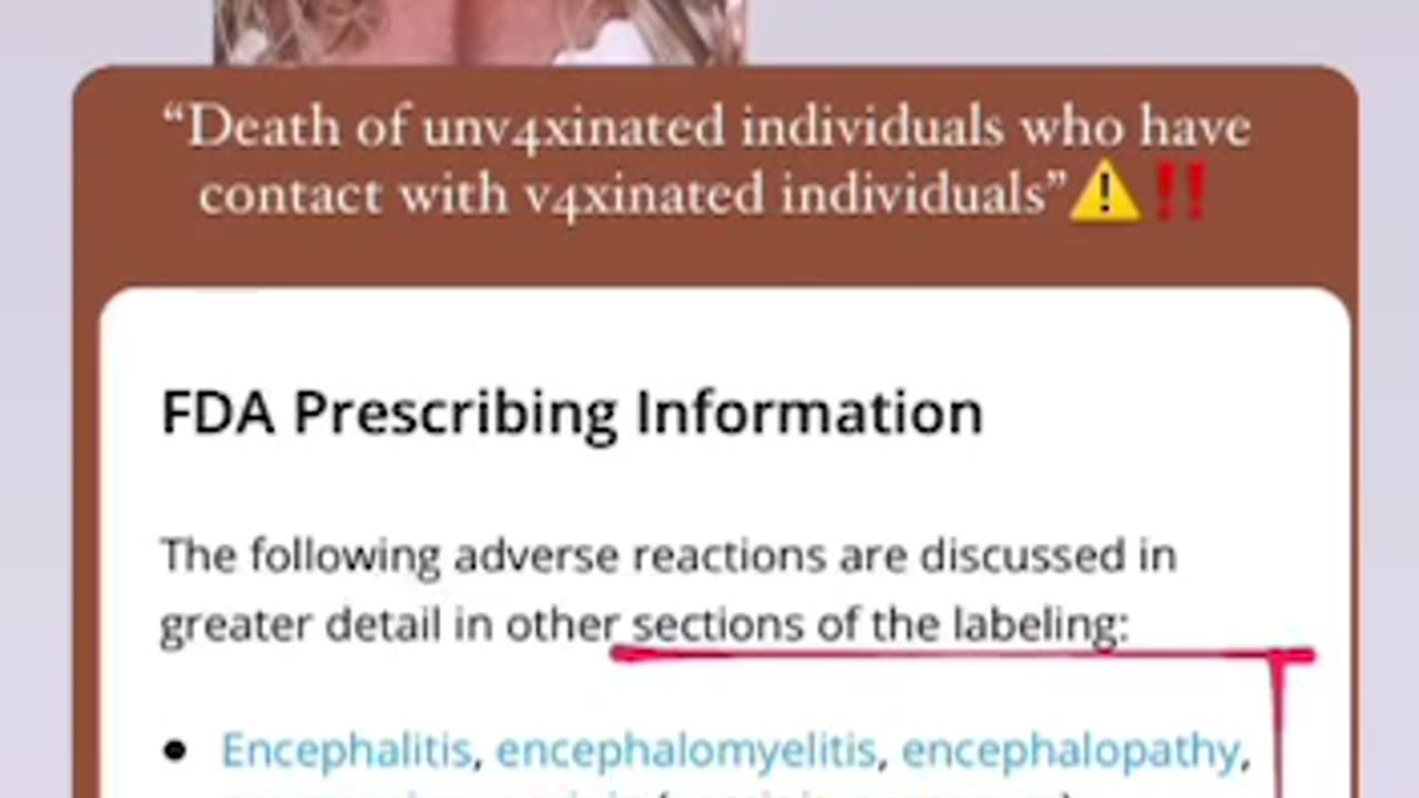 Adverse reactions for the newly approved ACAM2000 smallpox 💉