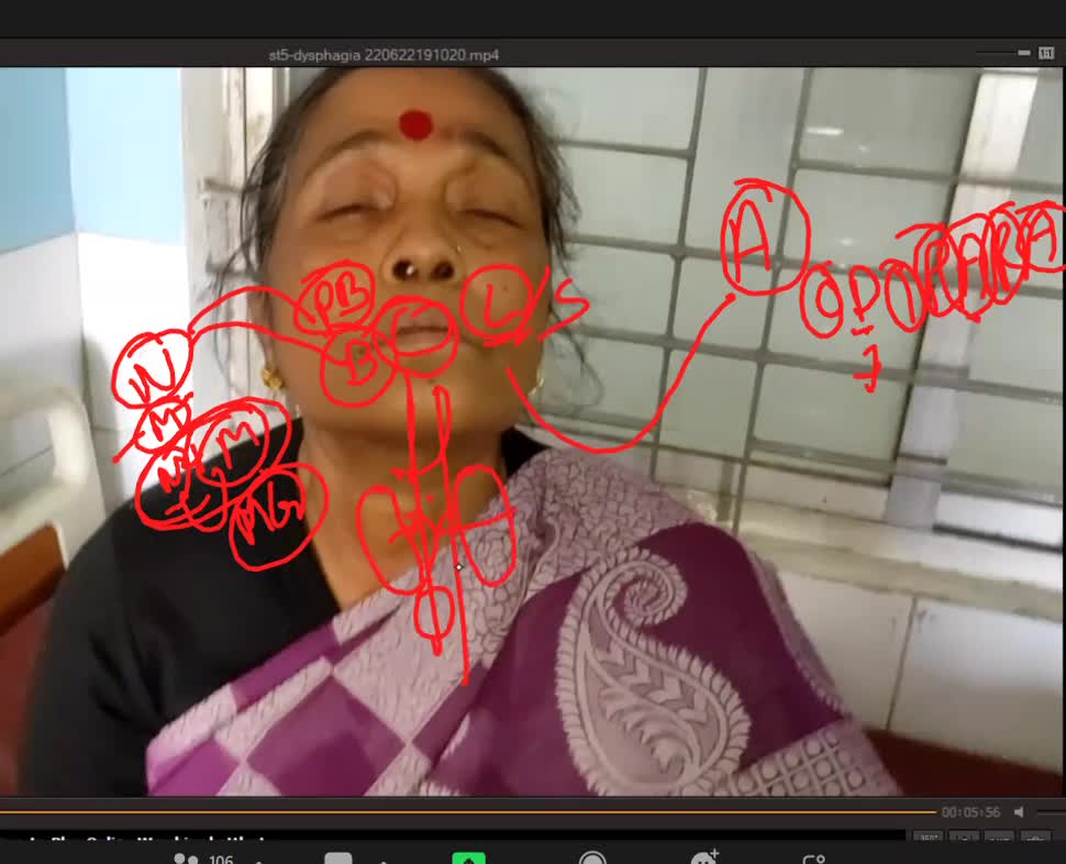 ST5.45 year old lady with difficulty swallowing scenario