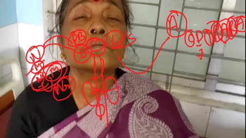 ST5.45 year old lady with difficulty swallowing scenario