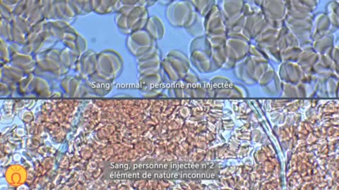 Nouvelles observations des Vaccins COVID au microscope