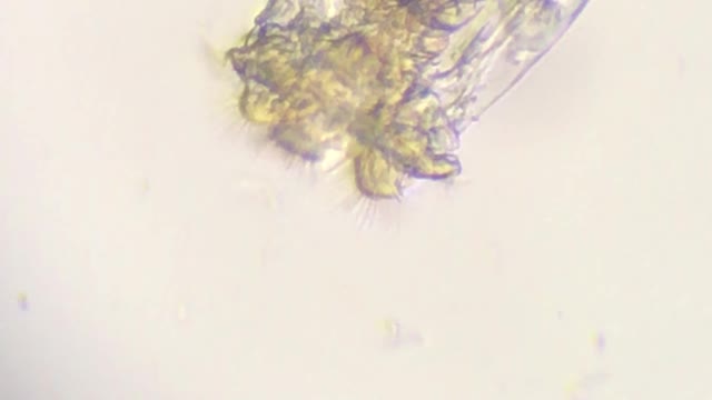 A Closeup of an “L” type Rotifer