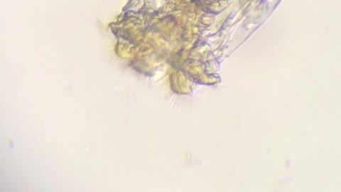 A Closeup of an “L” type Rotifer