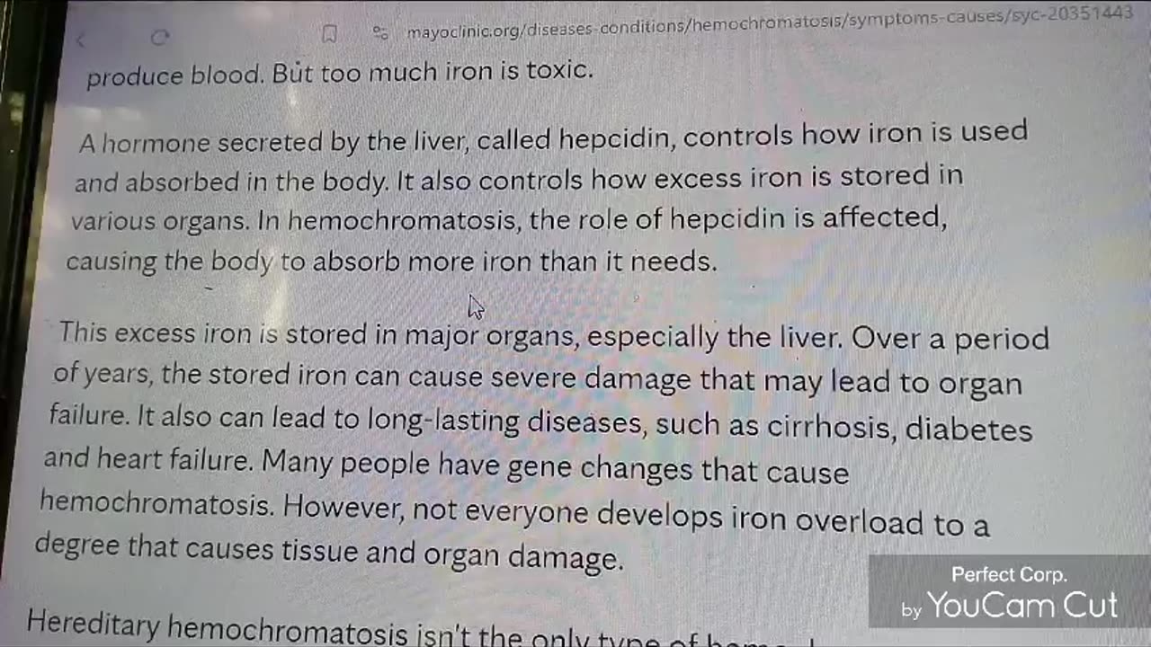 Hemochromatosis