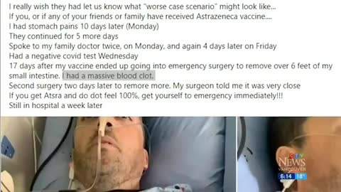 Vaccine Adverse Effects 2