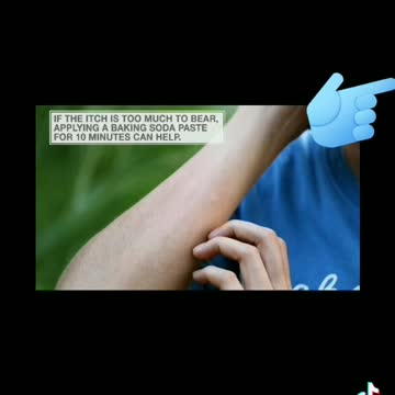 Why mosquitoes bites itch