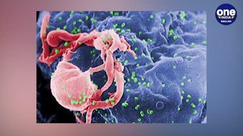 AIDS_ Drug developed by gene editing could cure the chronic condition _ Oneindia news _Health