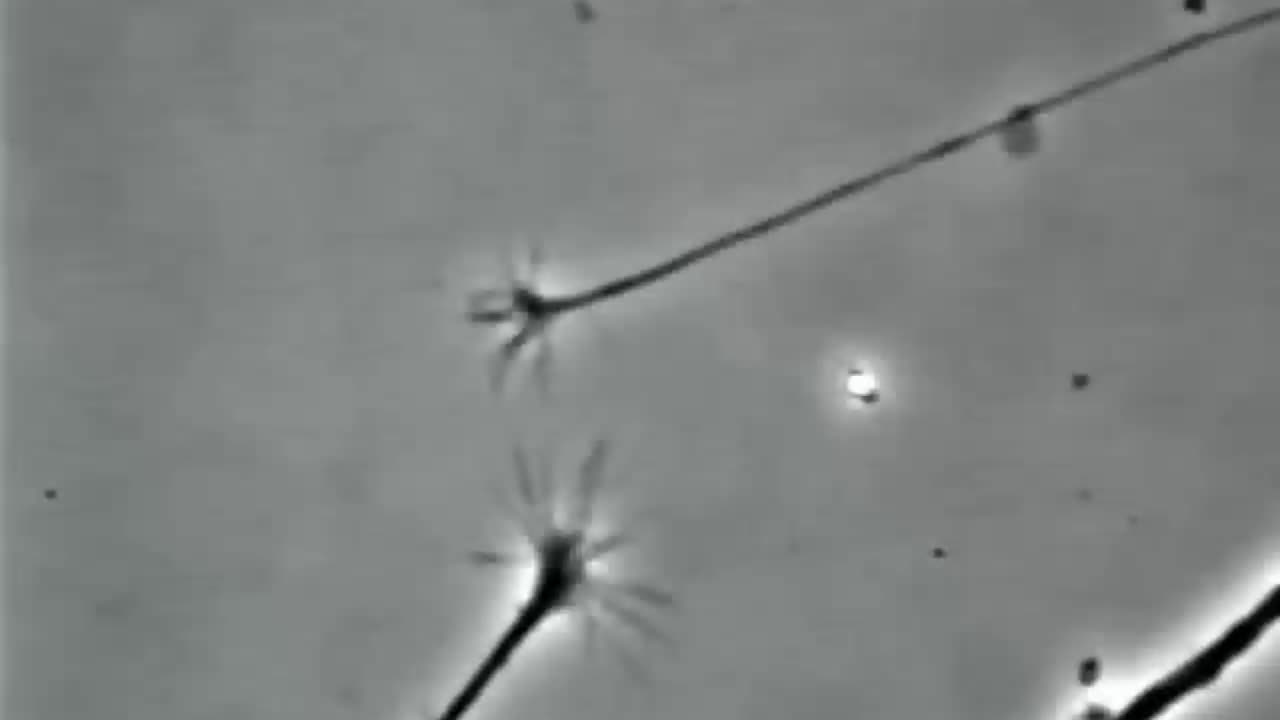 These are 2 neurons under the microscope watch them connect