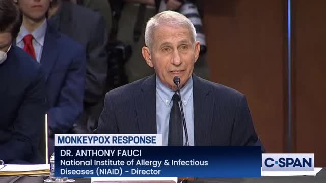 DR Fauci looks very very scared his hands are shaking like a leaf in exchange with Rand Paul