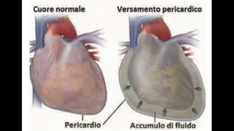 La vera causa di morte di Gesu' rivelata!