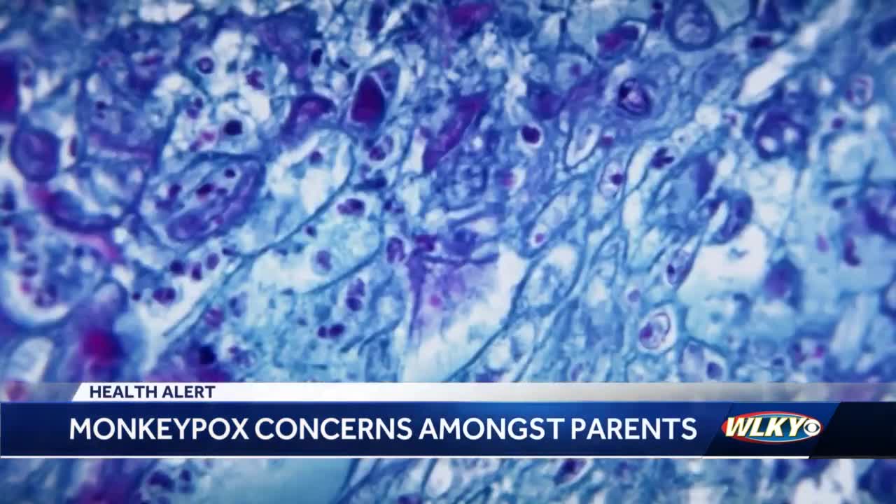 How to protect your children from monkeypox