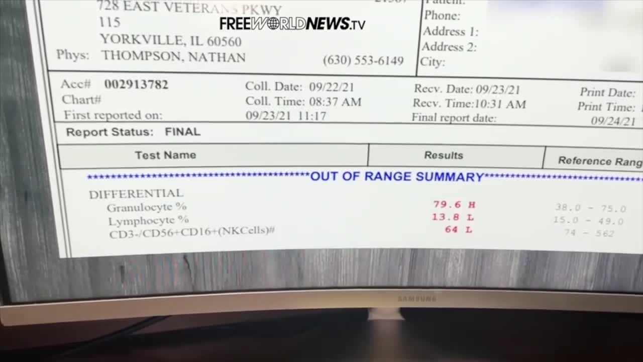 Dr Thompson Blood Work Samples