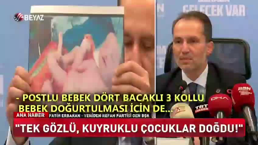 TV turca afferma nascite deformi dopo vaccini antiCovid?